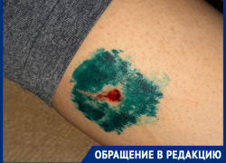 Агрессивные бродячие собаки покусали юную таганроженку Агрессивные бродячие собаки покусали юную таганроженку
