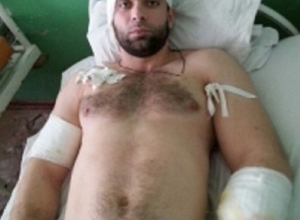 Таганрогскому чемпиону по паурлифтингу ампутировали руку после удара током в 6000 вольт